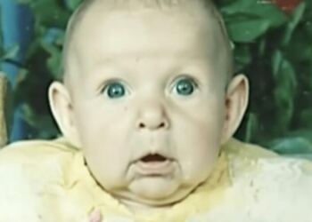 Το πρόσωπο αυτού του μωρού άλλαζε από μέρα σε μέρα – Μόλις οι γιατροί κατάλαβαν το γιατί…