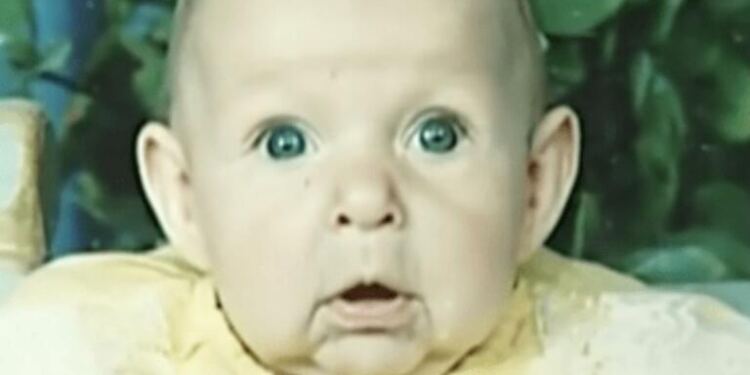 Το πρόσωπο αυτού του μωρού άλλαζε από μέρα σε μέρα – Μόλις οι γιατροί κατάλαβαν το γιατί…