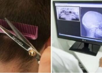 Μετά Το Κούρεμα, Μεταφέρθηκε «Εσπευσμένα» Στην Eντατική. 3 Μέρες Μετά, Συνειδητοποίησε Το Μοιραίο Λάθος Της Κομμώτριας…