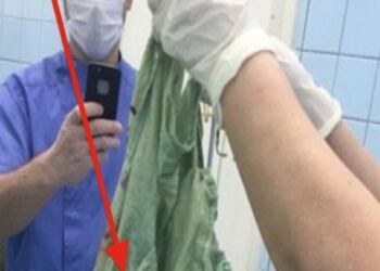 Η κοιλιά της 34χρονης μεγάλωνε συνεχώς – Όταν την άνοιξαν οι γιατροί, δεν πίστευαν αυτό που έβλεπαν