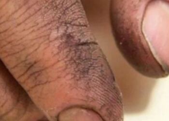 Πήρε τον Πατέρα του στο Μπάνιο και άρχισε να του Πλένει τα Χέρια. Τότε συνειδητοποίησε ΚΑΤΙ το Συγκλονιστικό!