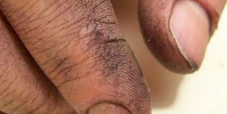 Πήρε τον Πατέρα του στο Μπάνιο και άρχισε να του Πλένει τα Χέρια. Τότε συνειδητοποίησε ΚΑΤΙ το Συγκλονιστικό!