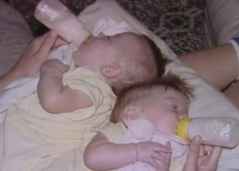 19 Χρόνια Πριν τους Είπαν να Μην Κάνουν την Εγχείριση. Αυτοί Δεν Άκουσαν και Ιδού τα Αποτελέσματα.