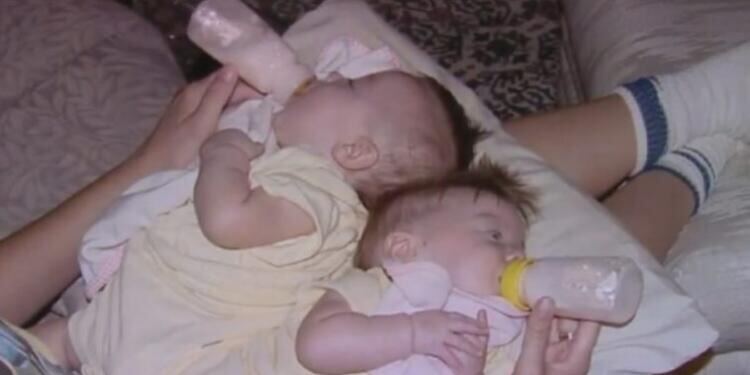 19 Χρόνια Πριν τους Είπαν να Μην Κάνουν την Εγχείριση. Αυτοί Δεν Άκουσαν και Ιδού τα Αποτελέσματα.