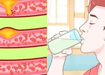 Βάλε τέλος σε χοληστερίνη και τριγλυκερίδια: Το φθηνό ρόφημα που καθαρίζει τις αρτηρίες και προστατεύει την καρδιά