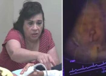 Πήγε για υπερηχογράφημα την έγκυο ανιψιά της – Μόλις όμως κοίταξε την oθόνη έπαθε το σοκ της ζωής της (Video)
