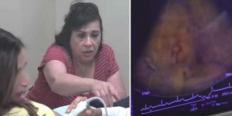 Πήγε για υπερηχογράφημα την έγκυο ανιψιά της – Μόλις όμως κοίταξε την oθόνη έπαθε το σοκ της ζωής της (Video)