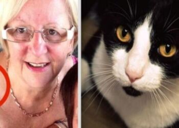Αυτή η 64χρονη γιαγιά δεν είχε ιδέα τι μεγάλωνε στον ώμο της – Η γάτα της όμως κατάλαβε ότι κάτι δεν πήγαινε καλά