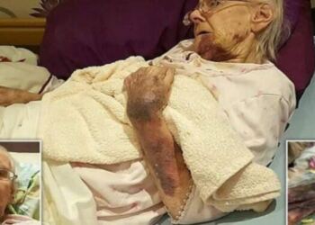 98χρονη γιαγιά είχε γεμίσει με μελανιές – Όταν ο εγγονός της κατάλαβε ποιος της το έκανε…