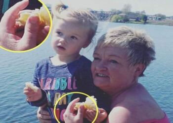 Τα νύχια 53χρονης είχαν πάρει ένα κυρτό σχήμα γύρω από τα δάχτυλά της- Η φωτογραφία και η αποκάλυψη-σοκ