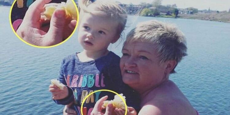 Τα νύχια 53χρονης είχαν πάρει ένα κυρτό σχήμα γύρω από τα δάχτυλά της- Η φωτογραφία και η αποκάλυψη-σοκ