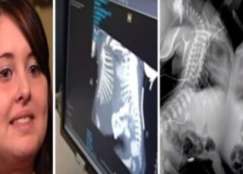 27χρονη έγκυος πήγε να κάνει υπερηχογράφημα – Όταν το είδαν οι γιατροί πάγωσαν και της είπαν..