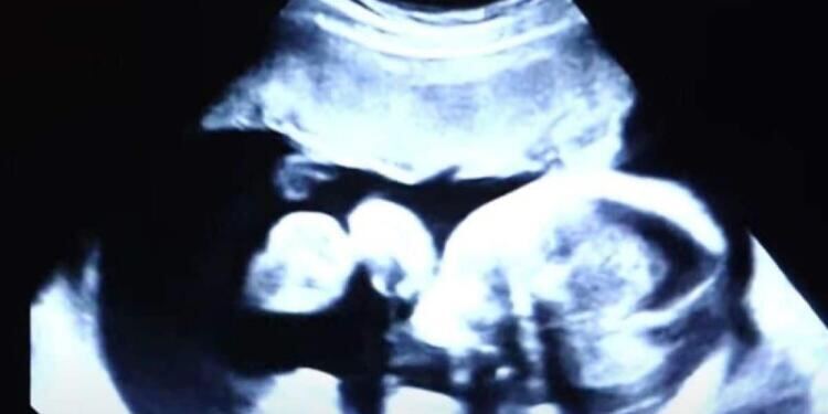 52χρονη είναι έγκυος στα δίδυμα παιδιά του γαμπρού της – Όταν όμως οι γιατροί είδαν τον τελευταίο υπέρηχο «πάγωσαν»