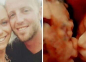 24χρονη έγκυος πήγε για υπερηχογράφημα – Μόλις κοίταξε την οθόνη πάγωσε