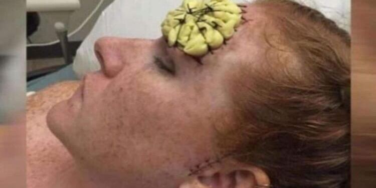 39χρονη έμεινε έγκυος και φύτρωσε στο μέτωπό της κάτι παράξενο – Μόλις της το αφαίρεσαν οι γιατροί «πάγωσαν»