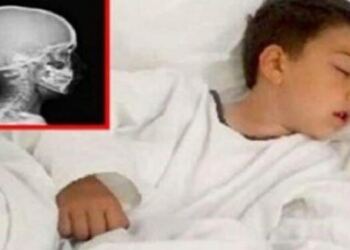 Έψησε ένα μπιφτέκι να φάει ο γιος της που πεινούσε! Λίγη ώρα αργότερα, έτρεχαν στα επείγοντα…