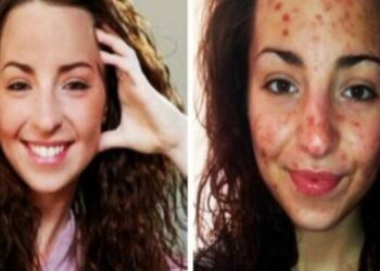 20χρονη έκανε κάτι που κάνουμε όλοι καθημερινά για 6 ώρες την ημέρα – Τι της συνέβη; Σοκαριστικό