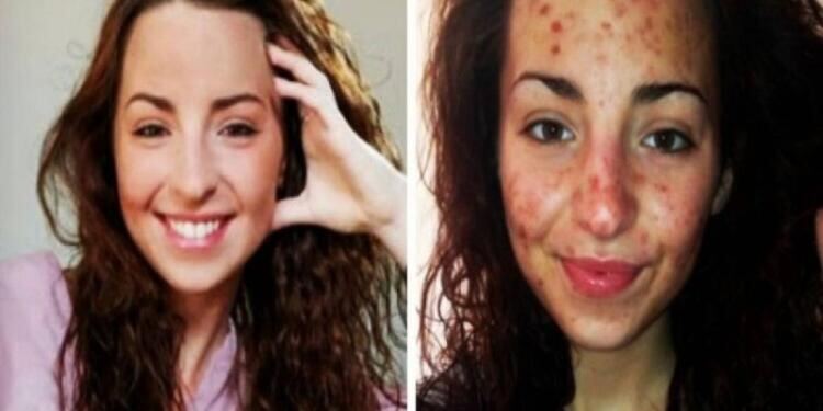 20χρονη έκανε κάτι που κάνουμε όλοι καθημερινά για 6 ώρες την ημέρα – Τι της συνέβη; Σοκαριστικό