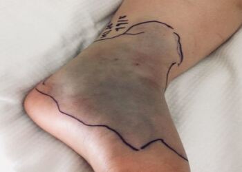 Όταν είδε το παιδί της σε αυτή την κατάσταση, της κόπηκαν τα πόδια!