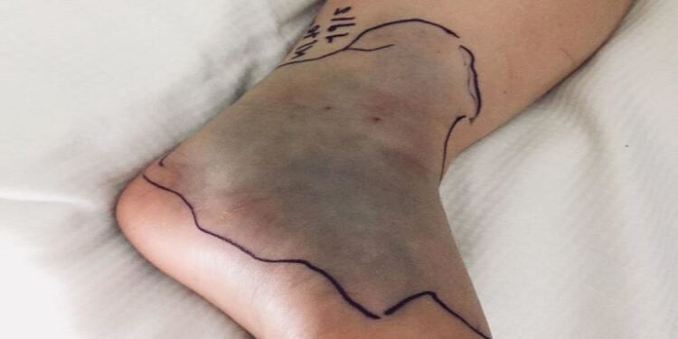 Όταν είδε το παιδί της σε αυτή την κατάσταση, της κόπηκαν τα πόδια!