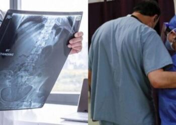 Τα ‘χασαν ακόμα κι οι γιατροί με αυτό που είδαν στο στομάχι 18χρονης