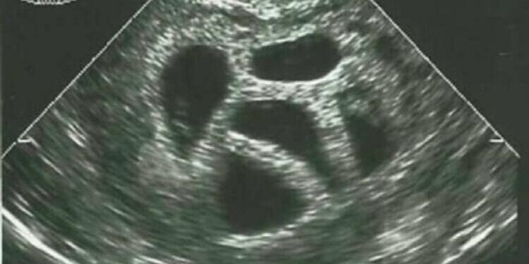 Μια έγκυος γυναίκα αγνόησε τις συμβουλές του γιατρού να κάνει έκτρωση… 20 χρόνια αργότερα δημοσιεύει αυτό!