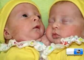 Όταν είδαν οι γιατροί το υπερηχογράφημα 36χρονης εγκύου, πάγωσαν! Χωρίς δεύτερη σκέψη της είπαν… (Video)