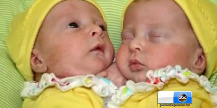 Όταν είδαν οι γιατροί το υπερηχογράφημα 36χρονης εγκύου, πάγωσαν! Χωρίς δεύτερη σκέψη της είπαν… (Video)