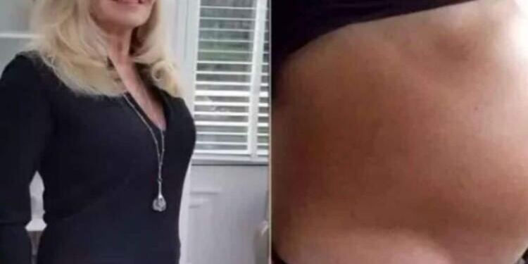 66χρονη πηγαίνει στο νοσοκομείο νομίζοντας πως είναι έγκυος – Όταν οι γιατροί της είπαν την αλήθεια «πάγωσε»…