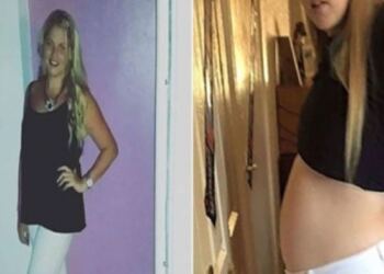 22χρονη νόμιζε ότι ήταν 8 μηνών έγκυος… Όταν οι γιατροί ανακάλυψαν τι πραγματικά μεγάλωνε στην κοιλιά της έπαθαν σοκ