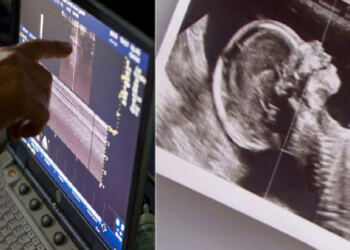 Συγκλονιστικό: Ζευγάρι με δίδυμα περιμένει και πάλι παιδί, αλλά ο γιατρός δείχνει το υπερηχογράφημα και ο σύζυγος αμέσως λιποθυμά