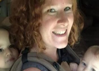 Δεν θα το πιστεύετε! Όταν έμεινε έγκυος κάτι παράξενο φύτρωσε στο μέτωπό της – Αυτό που της αφαίρεσαν οι γιατροί τους έκανε να “παγώσουν”