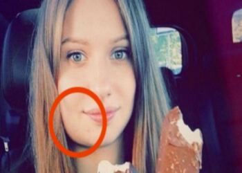 Αυτή η έγκυος ξύπνησε και είδε το σαγόνι της πρησμένο – Μόλις πήγε στο νοσοκομείο…Ανατριχιαστικό!