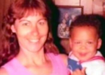 Γυναίκα Υιοθετεί Παιδί που κανείς δεν Θέλει να Βλέπει. 30 Χρόνια αργότερα, συνέβη κάτι τραγικό..