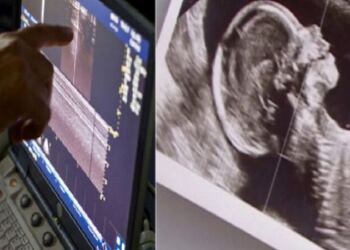 Συγκλονιστικό: Ζευγάρι με δίδυμα περιμένει και πάλι παιδί, αλλά ο γιατρός δείχνει το υπερηχογράφημα και ο σύζυγος αμέσως λιποθυμά