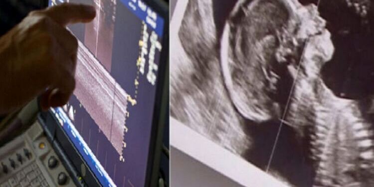 Συγκλονιστικό: Ζευγάρι με δίδυμα περιμένει και πάλι παιδί, αλλά ο γιατρός δείχνει το υπερηχογράφημα και ο σύζυγος αμέσως λιποθυμά