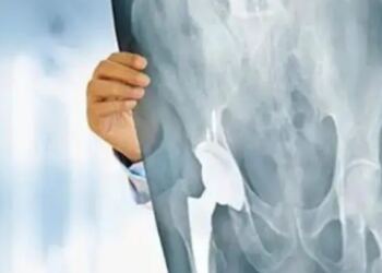 Άφωνοι οι Γιατροί στο νοσοκομείο Μυτιλήνης με 99χρονη μετά από εγχείρηση για κάταγμα ισχύου – Δείτε τι συνέβη