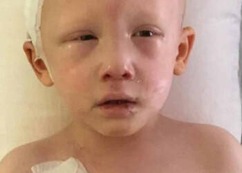 Ψιθύρισε 3 λέξεις και τους “πάγωσε” όλους: 3χρονο αγοράκι με καρκίνο ανοίγει τα μάτια του για τελευταία φορά