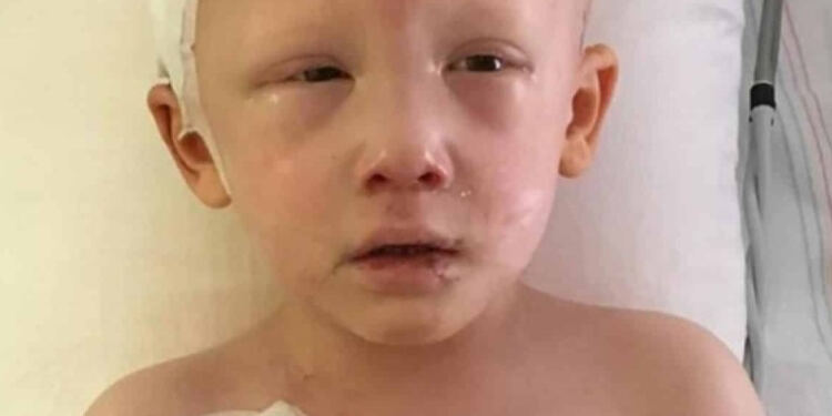 Ψιθύρισε 3 λέξεις και τους “πάγωσε” όλους: 3χρονο αγοράκι με καρκίνο ανοίγει τα μάτια του για τελευταία φορά