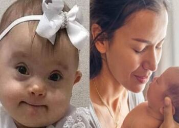 «Γροθιά» στο στομάχι: «Αγαπητέ γιατρέ, το παιδί που μου είπατε να “ρίξω” μάς έχει χαρίσει τα πιο πλατιά χαμόγελα…»