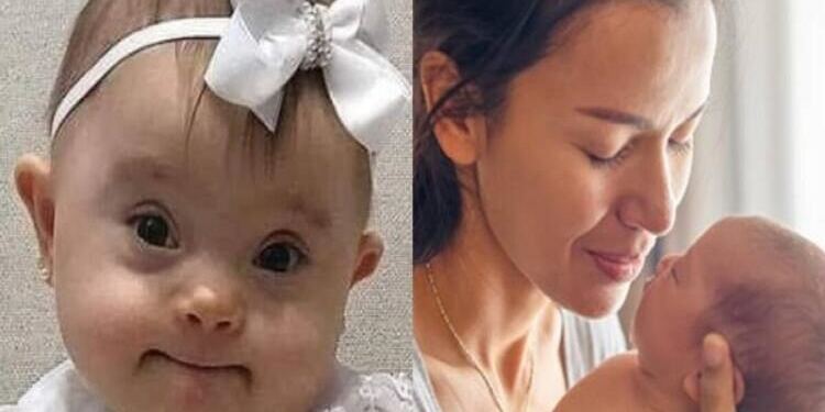 «Γροθιά» στο στομάχι: «Αγαπητέ γιατρέ, το παιδί που μου είπατε να “ρίξω” μάς έχει χαρίσει τα πιο πλατιά χαμόγελα…»