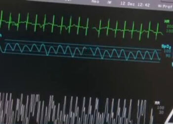 Έβαλε το χεράκι της γύρω από την αδερφούλα της που πέθαινε… Αυτό που συνέβη μετά όμως δεν το περιμέναμε!