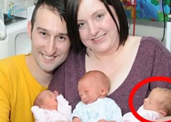 36χρονη έγκυος γέννησε υγιή τρίδυμα – Μετά από 10 λεπτά ο γιατρός είδε ένα μεγάλο λάθος