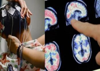 Είχε έντονες ημικρανίες και πήγε στον γιατρό – Όταν εξέτασαν τον εγκέφαλό του έπαθαν σοκ με αυτό που αντίκρισαν