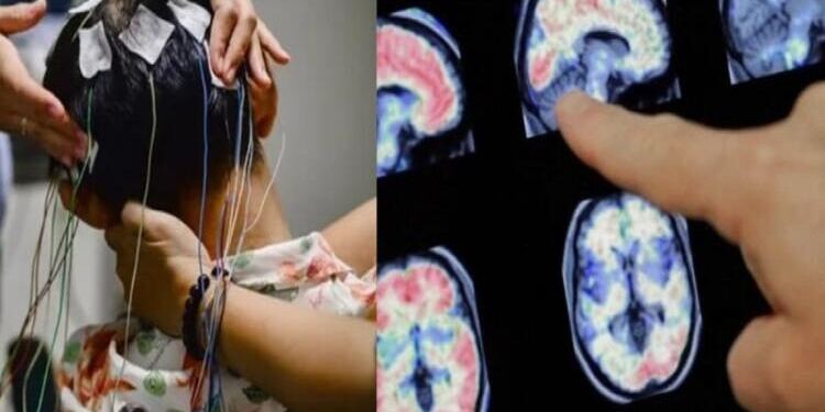 Είχε έντονες ημικρανίες και πήγε στον γιατρό – Όταν εξέτασαν τον εγκέφαλό του έπαθαν σοκ με αυτό που αντίκρισαν