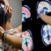 Είχε έντονες ημικρανίες και πήγε στον γιατρό – Όταν εξέτασαν τον εγκέφαλό του έπαθαν σοκ με αυτό που αντίκρισαν