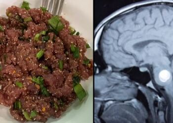 Μην φάτε ποτέ αυτό το φαγητό – Προκαλεί καρκίνο στο συκώτι με μια μπουκιά
