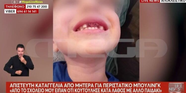 Σοκαριστική καταγγελία: 5χρονα έσπασαν τα δόντια 4χρονου με αυτισμό σε σχολείο – Δε θα μπορεί να φάει για 2 χρόνια