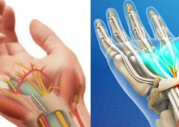 Μούδιασμα στα δάχτυλα: Τι δείχνει για την υγεία – Οι σοβαρές παθήσεις που κρύβει