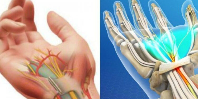 Μούδιασμα στα δάχτυλα: Τι δείχνει για την υγεία – Οι σοβαρές παθήσεις που κρύβει